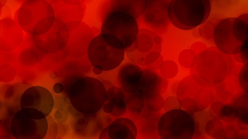 Japanese researchers say new artificial intelligence software can detect bowel cancer tumours . (Photo: Pixabay)